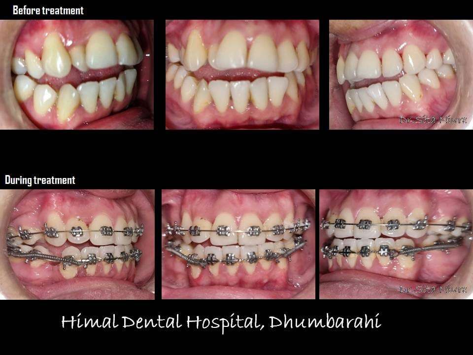 Himal Dental Hospital – & Institute of Dental Science